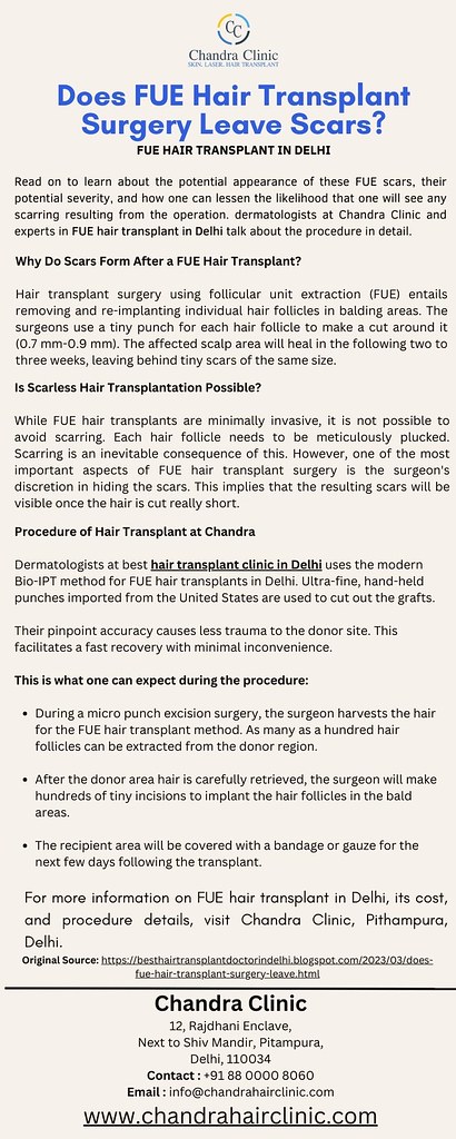 Hair Transplant Surgery in Delhi – Does FUE Hair Transplan…