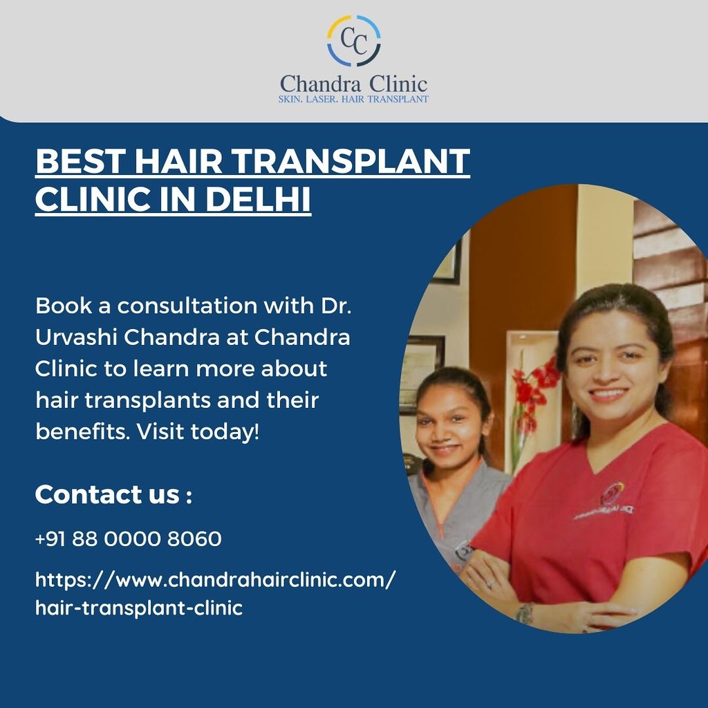 Best Hair Transplant Clinic in Delhi – Chandra Clinic